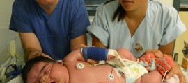 Born At 13.47 Pounds, Baby Jasleen Is Germany’s Heaviest Baby Born Vaginally Germany Heavy Newborn